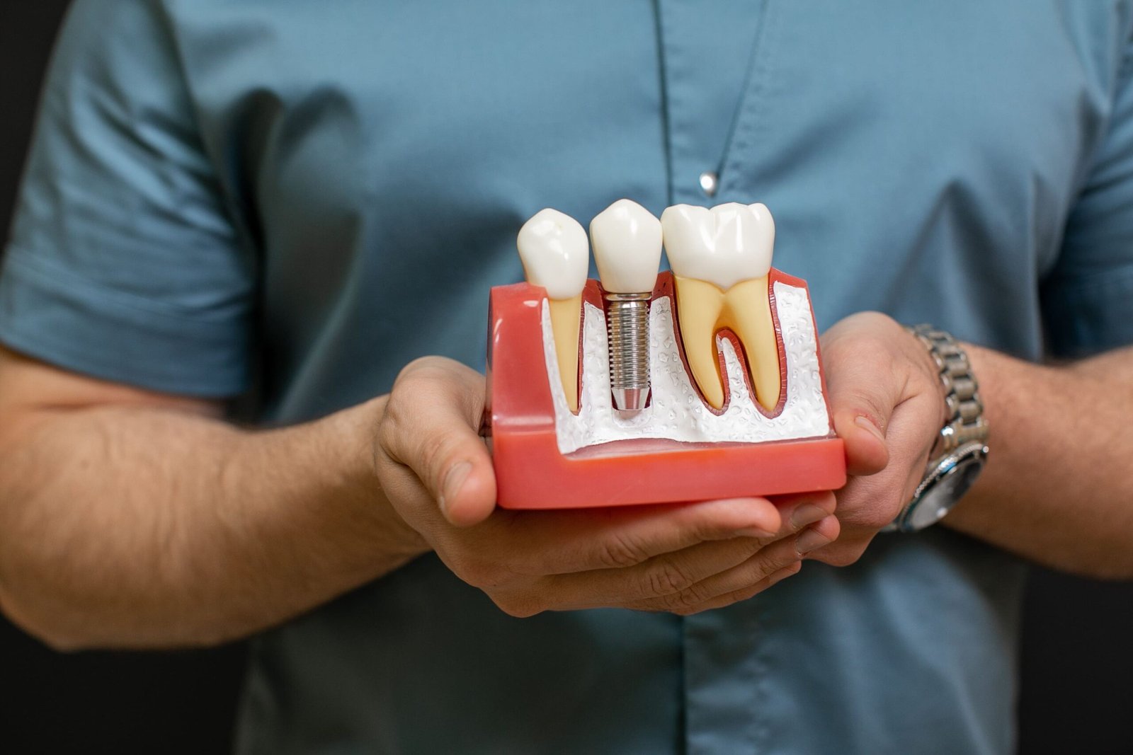 imagen de una figura de implantes dentales en la clinia laheradental en Carlet